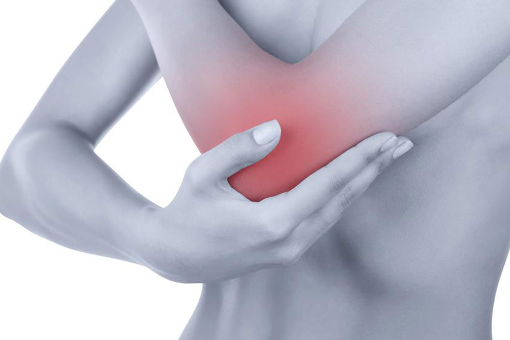 Here’s what you need to know about the causes of bursitis